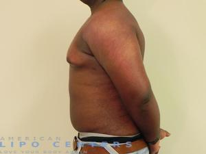 americanlipocenters_209.jpg
